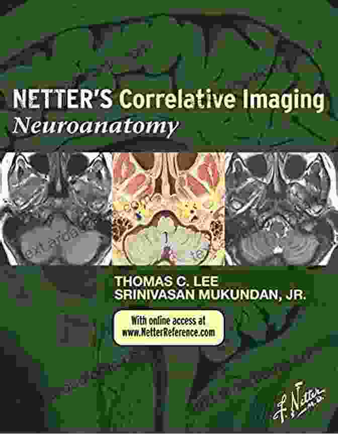 Netter Correlative Imaging Book Cover Netter S Correlative Imaging: Cardiothoracic Anatomy (Netter Clinical Science)