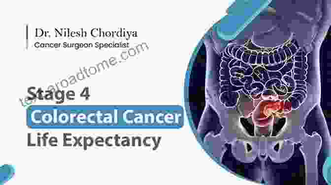 Stage Colon Cancer Life Expectancy Guide Colon Cancer Treatment: The Battle For Life From Colon Cancer: Stage 4 Colon Cancer Life Expectancy