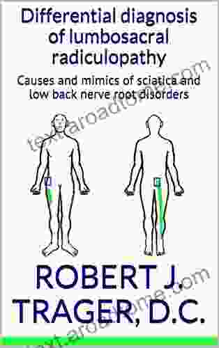 Lumbosacral Radiculopathy: Causes And Mimics Of Sciatica And Low Back Nerve Root Disorders