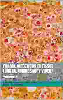 Fungal Infections In Tissue (Digital Microscopy Video): Volume 6